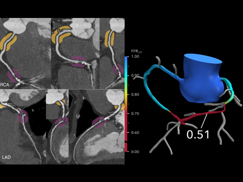 Best Cardiologist in Anandapur Kolkata